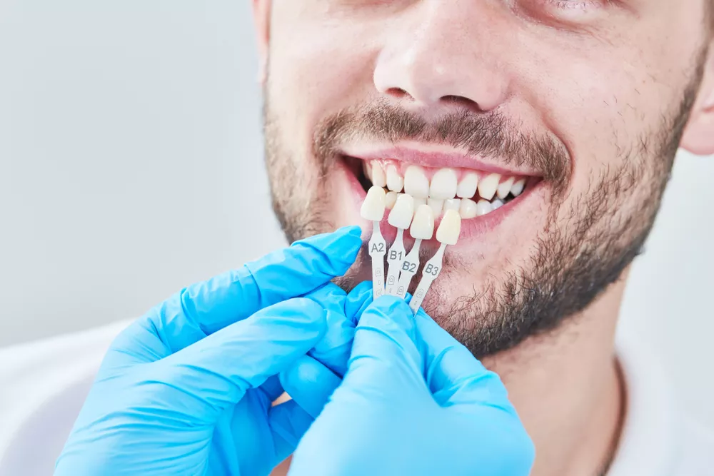 Top 10 Dental Implant Brands