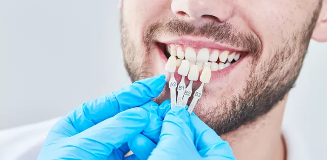 Top 10 Dental Implant Brands