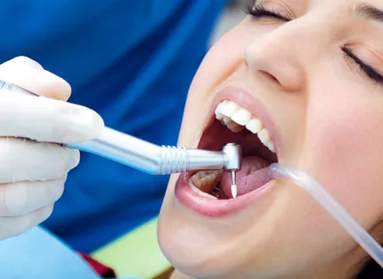 Does Tartar Cleaning Damage Teeth? 